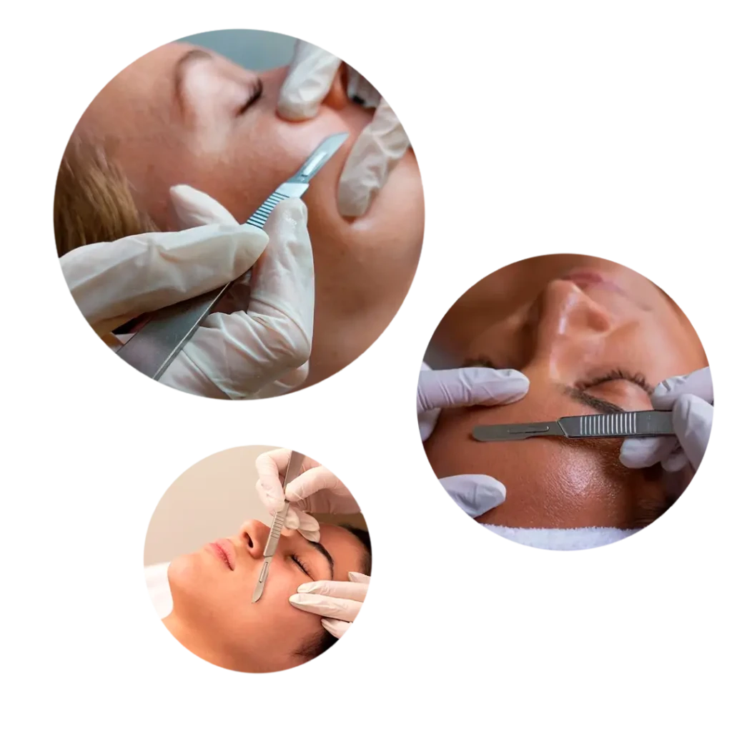 Dermaplaning_portada