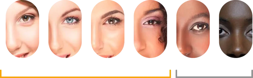Fototipos de pieles